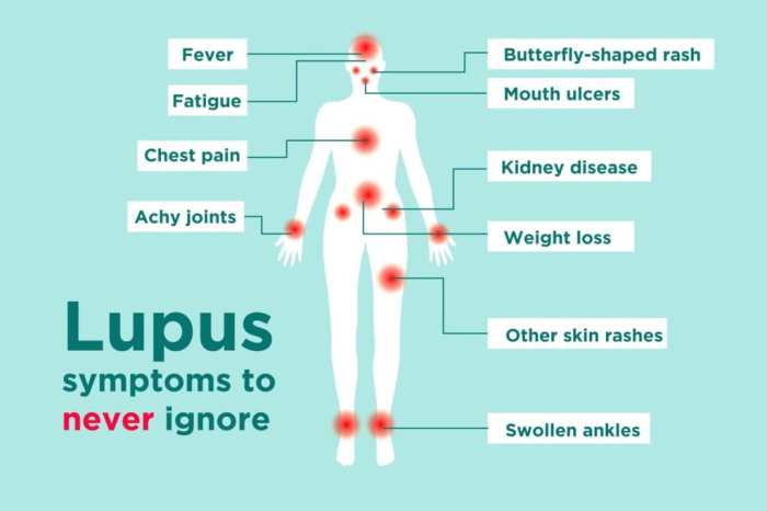 Lupus disease symptoms causes