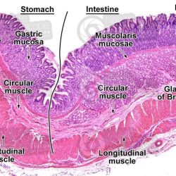 Gross sections