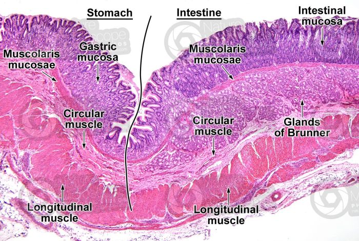 Gross sections